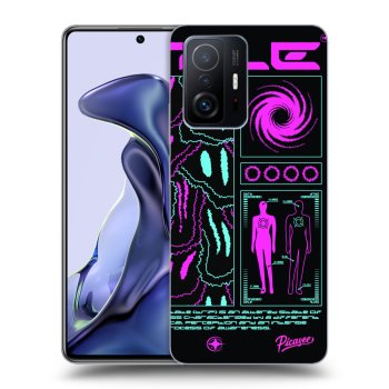 Hülle für Xiaomi 11T - HYPE SMILE