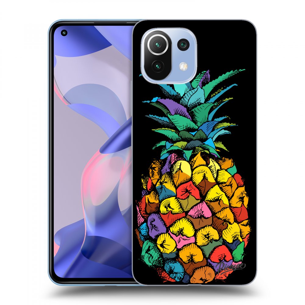 Picasee ULTIMATE CASE für Xiaomi 11 Lite 5G NE - Pineapple