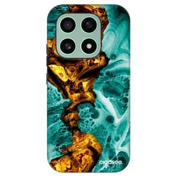 Hülle für Xiaomi 17 - Goldsky