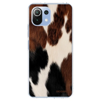 Picasee Xiaomi 11 Lite 5G NE Hülle - Transparentes Silikon - Rodeo