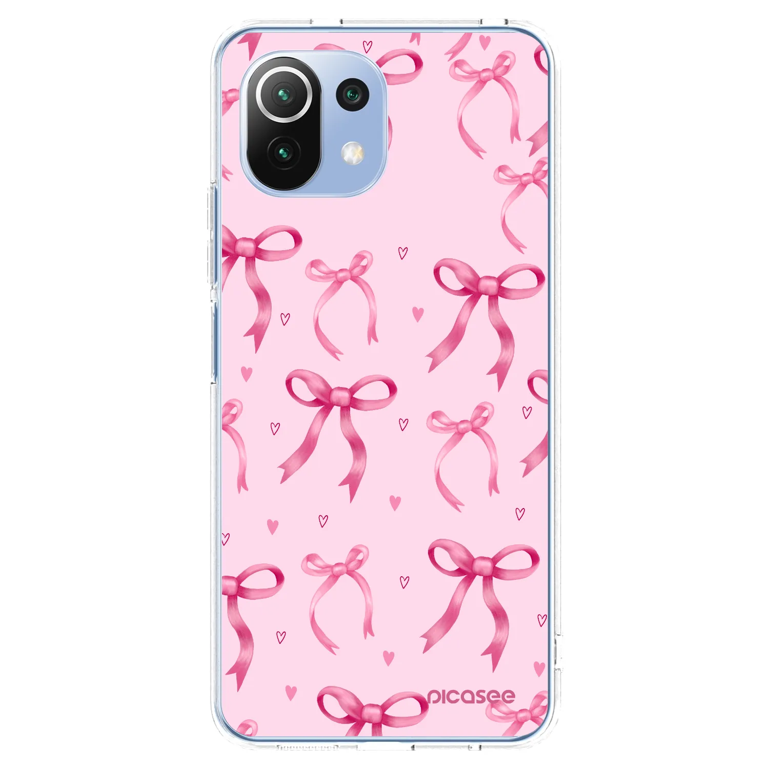 Picasee Xiaomi Mi 11 Lite Hülle - Transparentes Silikon - Bow Aesthetic