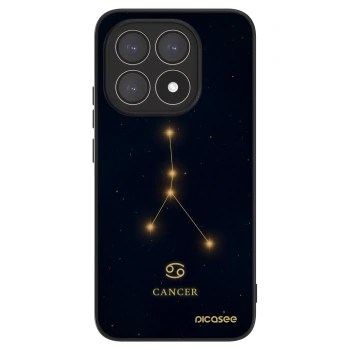 Hülle für Xiaomi 15T - CANCER