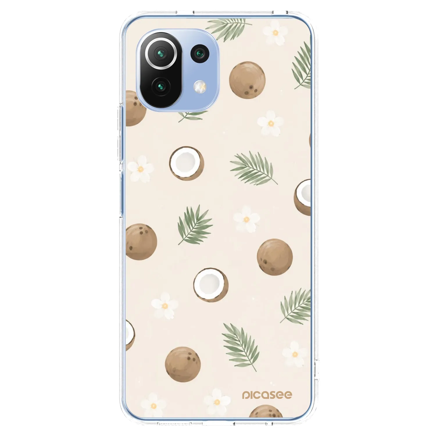 Picasee Xiaomi Mi 11 Lite Hülle - Transparentes Silikon - Coconut Breeze