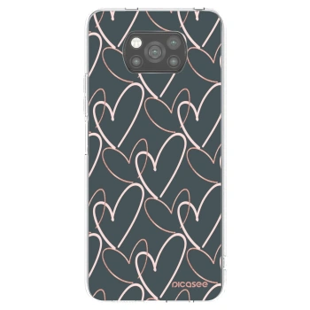 Picasee Xiaomi Poco X3 Hülle - Schwarzes Silikon - Viel Liebe
