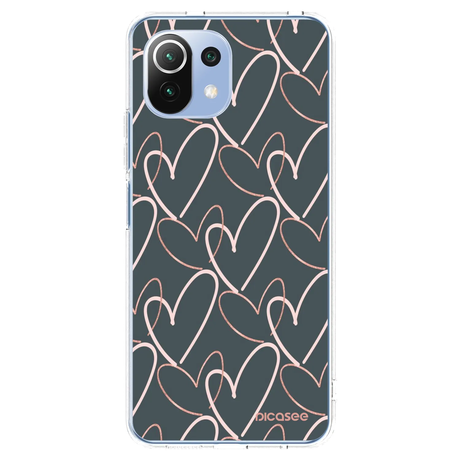Picasee Xiaomi 11 Lite 5G NE Hülle - Transparentes Silikon - Viel Liebe